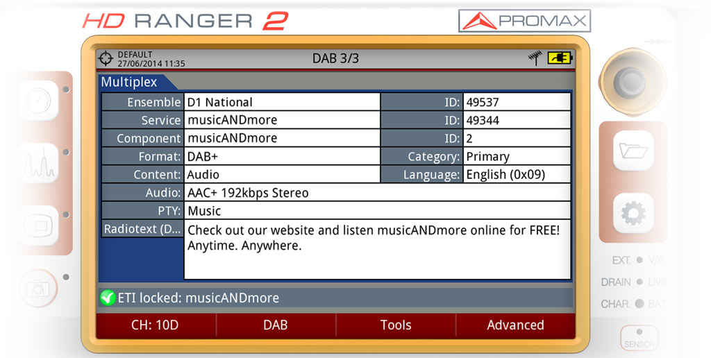 Données extraites du multiplex d'émission d'un signal DAB+ parmi lesquels : format (DAB ou DAB+), type d'audio (codec audio et taxe de bits), PTY (type de programme), contenu du radio texte, etc.